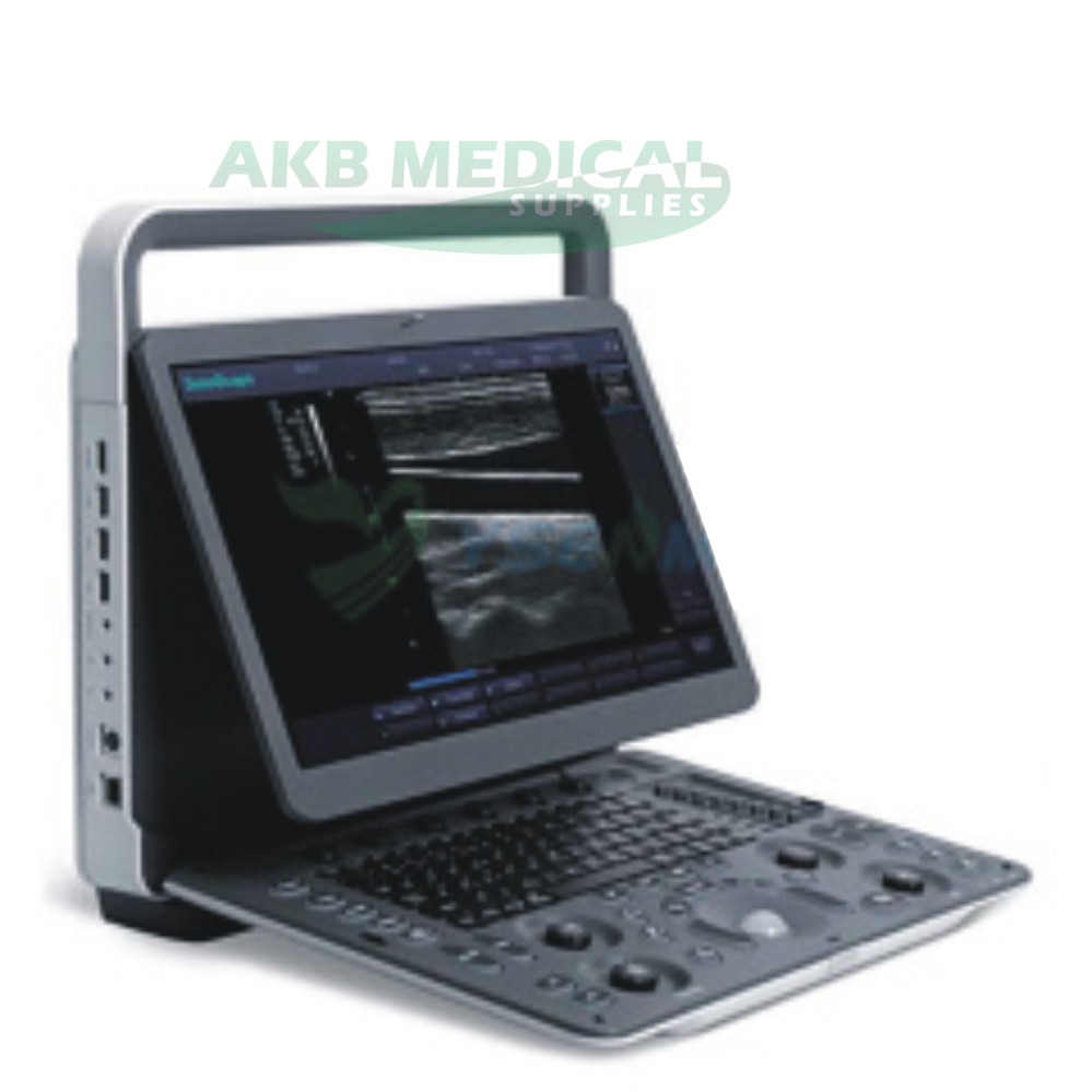 Sonoscape E2 portable colour doppler ultrasound machine